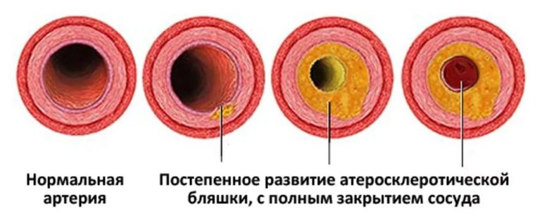 Как восстановить потенцию причины снижения, польза здорового образа.